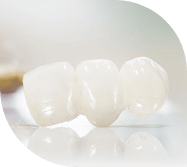 3 unit dental crown bridges in mexico