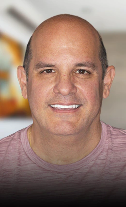 Young bald patient smiling with his 3 on 6 dental implants