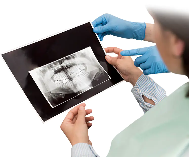 dentist holding an X-ray of a patient who will get an orthognathic suregery in mexicio
