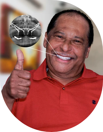 patient of cancun dental design smiling after getting zygomatic dental implants in mexico
