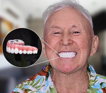 patient with a full set of emax dental crowns