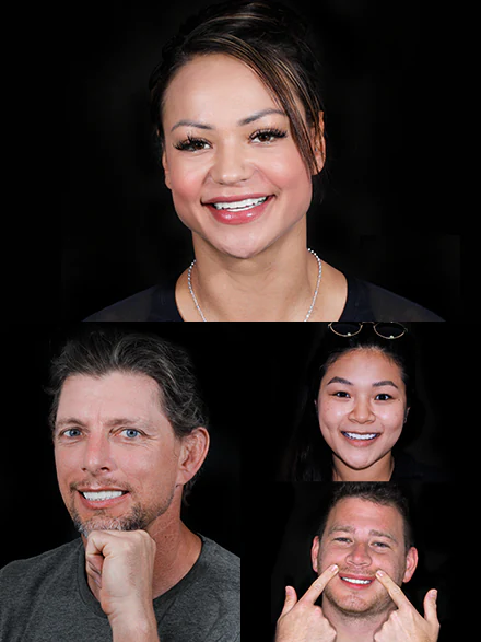 before and after pictures of cancun dental design patients who had a teeth whitening treatment