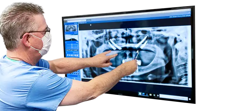 dentist at cancun dental design explaining what is the quad zygomatic dental implant treatment