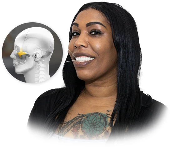 Example of Cancun Dental Design Patient with Zygomatic Dental Implants