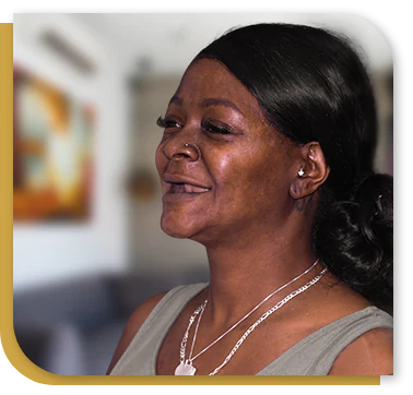 black woman patient at cancun dental design, before getting dental implants and dental bone graft