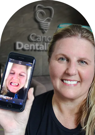 real patient before and after dental implants