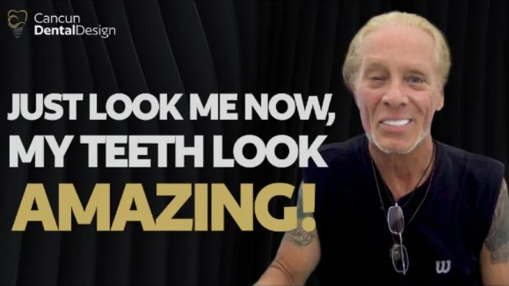 real patient review of zygomatic dental implants in cancun mexico