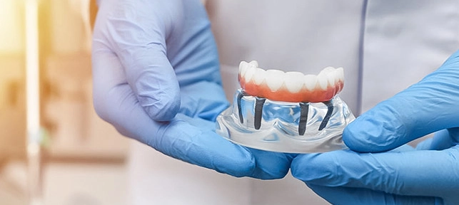 snap denture in cancun cdd