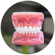 Ceramic Braces treatment