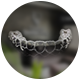 Clear Aligners Invisalign treatment