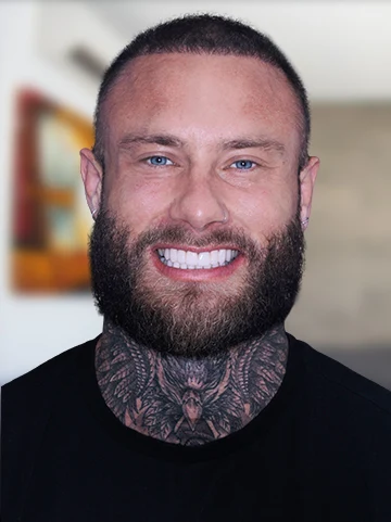 picture of younf man patient at cancun dental design smiling with his dental veneers
