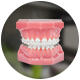 Damon Braces treatment