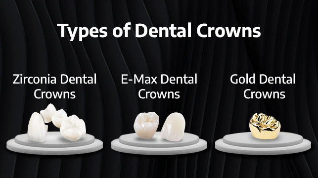 photo of the different dental crowns available from Cancun Dental Desing