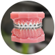 Metalic Braces treatment