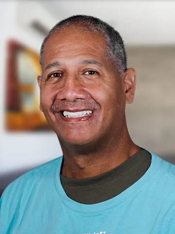 black man patient at cancun dental design smiling with his snap-on dentures