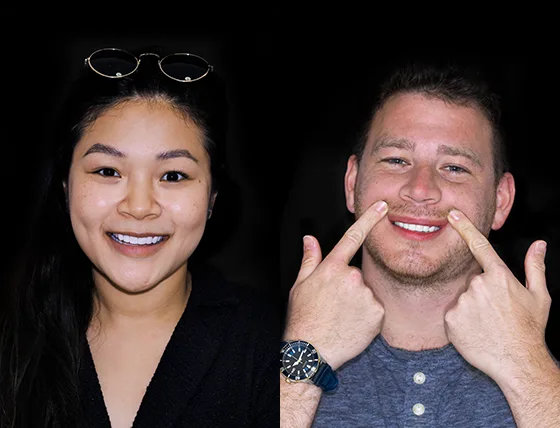 Before and after photos of patients who underwent laser whitening