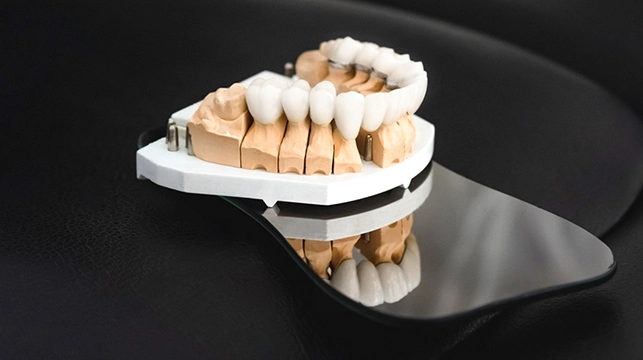 in-office dental crown molds