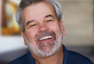 man with a snap-on denture in mexico
