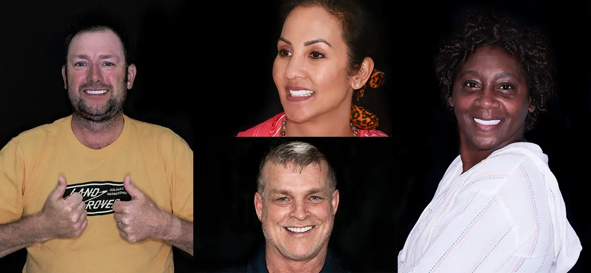 Patients with 3 on 6 dental implants before and after photos