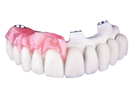 new crystal ultra hybrid all on 4 dental implants