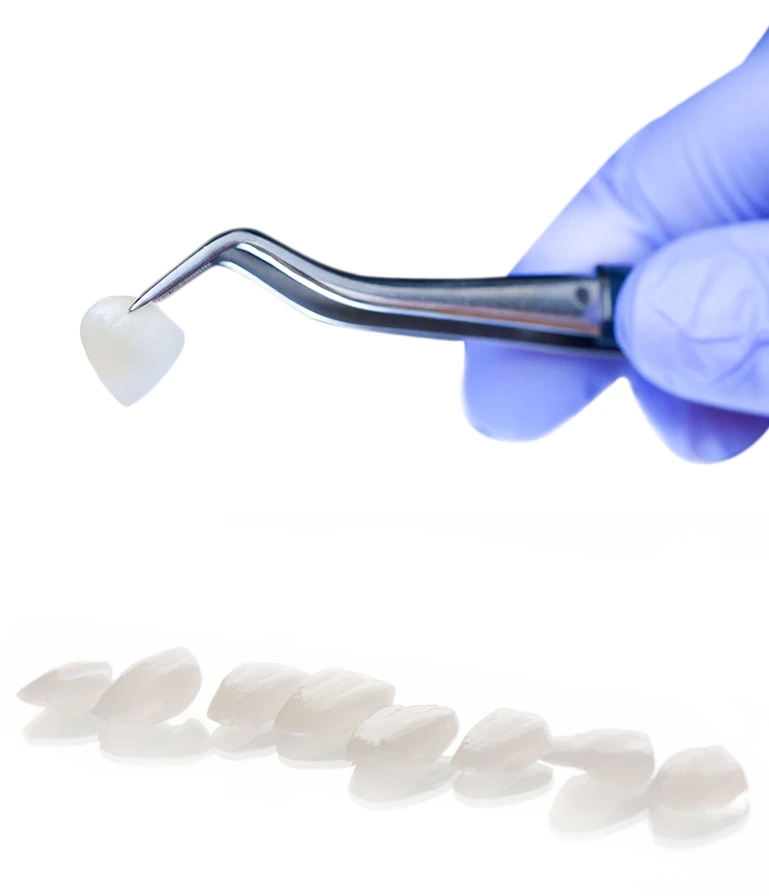 composite vs porcelain veneers