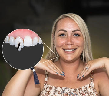 patient with a laser teeth whitening treatment