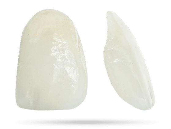 cost of dental veneers in Mexico, before and after