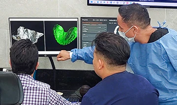 cancun dental design dentist during the preparation process of root canal therapy