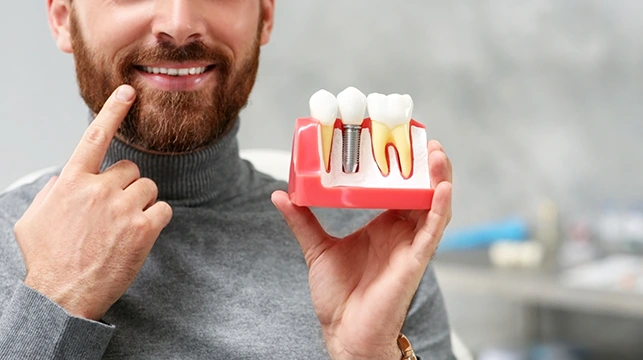 photo of dental implant held by a dentist
