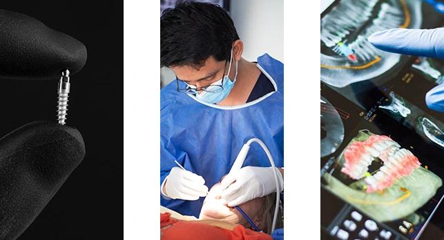 photo of dental implant held by a dentist