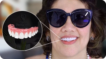 A smiling Latina woman wearing stylish sunglasses, showcasing the high-end aesthetic of a Zirconia All-on-4 dental implant bridge