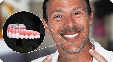 Confident Caucasian man pointing to his new smile, highlighting a Nano Ceramic All-on-4 dental restoration for a natural-looking, lightweight, and modern full-mouth restoration.