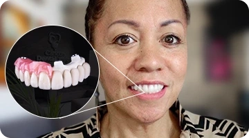 An Latina American woman smiling brightly to showcase her Titanium Hybrid All-on-4 dental implants, emphasizing a strong, long-lasting, and functional full-arch solution.