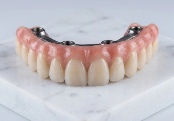 A close-up view of a custom-made fixed hybrid denture, designed for an All-on-4 dental implant restoration, resting on a marble surface and showcasing its durable metal framework and natural aesthetics at Cancun Dental Design.
